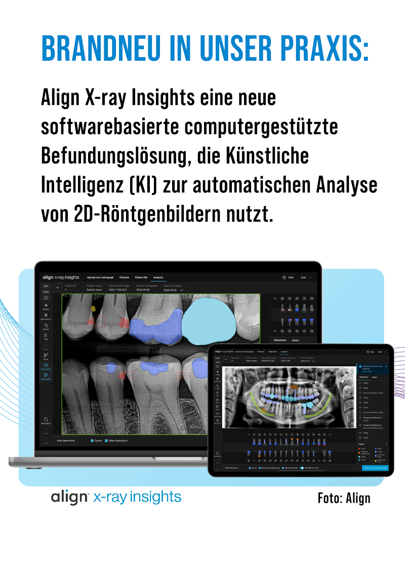 popup_aline_x_ray.png